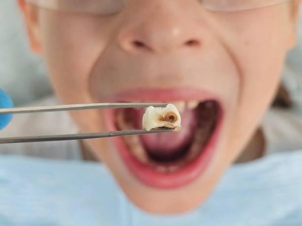 Best Pediatric Emergency Dentist in Gold Key Lake, PA
